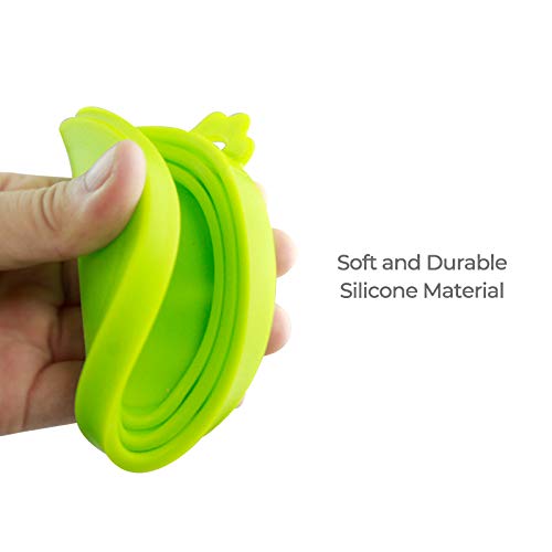 Yobbai 6 packs Pet Food Can Lids, Food Safe BPA-Free & Dishwasher Safe, Can Covers Most Standard Size Dog and Cat Can Tops