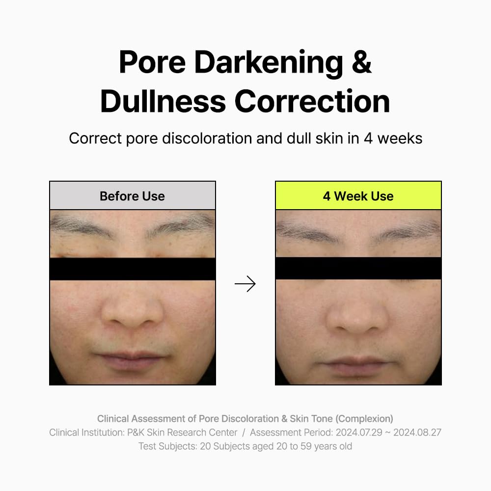 By Wishtrend Pore Smoothing Bakuchiol Serum 1.01 Fl Oz, Pore Minimizer Enhanced with Bakuchiol & Niacinamide, Peptide, Increase production of Collagen Fiber, for saggy & enlarged pores