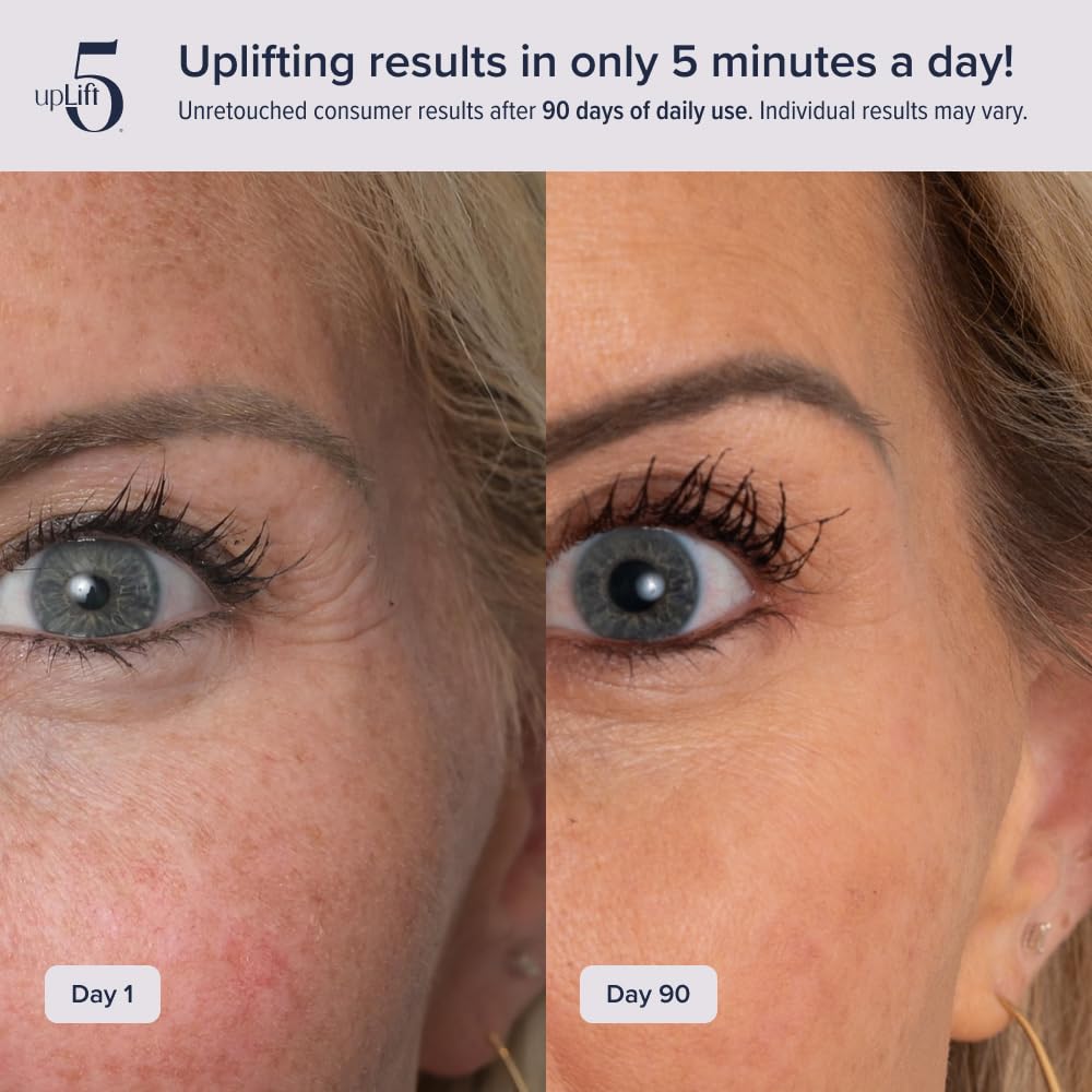 upLift 5 Pulsating Facial Lift | 5 Minute Age Reversal Device, Contours & Improves Facial Structures, Tightening & Toning of Skin