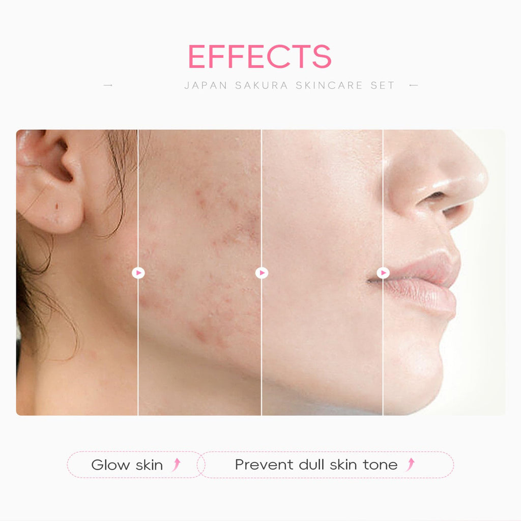 Skin Care Set For Teenagers Girls with Cute Mini Luggage,Sakura Skin Care Sets & Kits,Pamper Sets For Girls Gifts,Skincare Set,Serum,Cleanser,Sleep Mask,Mud Mask,Lip Mask,Hair Pins (Sakura)
