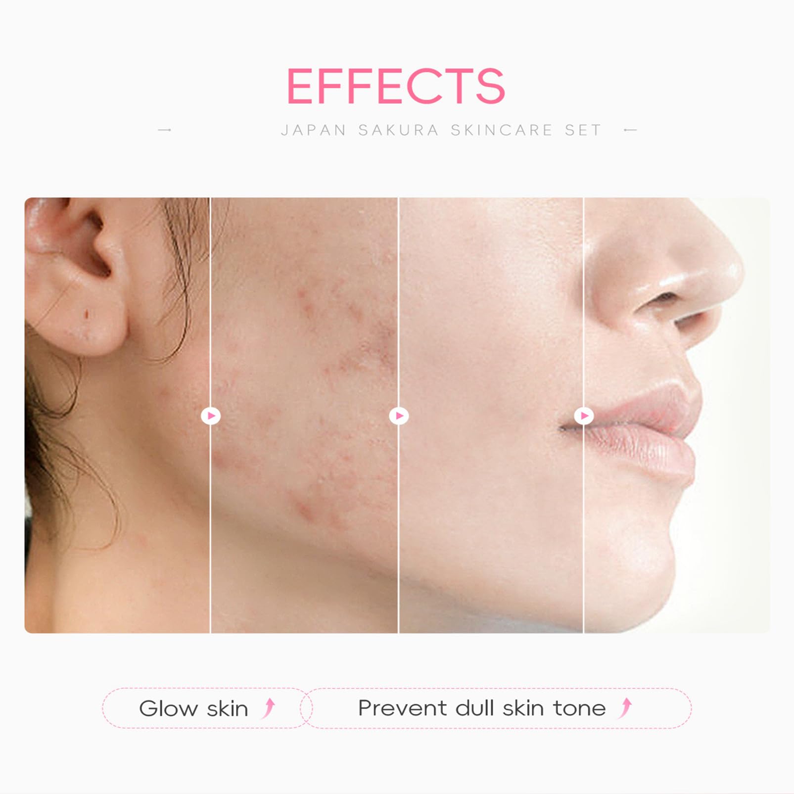 Skin Care Set For Teenagers Girls with Cute Mini Luggage,Sakura Skin Care Sets & Kits,Pamper Sets For Girls Gifts,Skincare Set,Serum,Cleanser,Sleep Mask,Mud Mask,Lip Mask,Hair Pins (Sakura)
