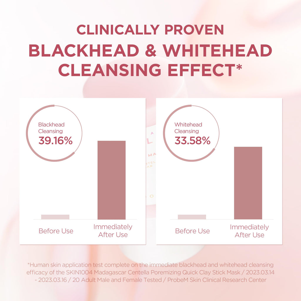 SKIN1004 Valentine Gifts, Poremizing Quick Clay Stick Mask, Face Masks Skincare for Pore Minimizing, Facial Clay Mask with Madagascar Centella, Pore Mask for Sebum, Korean Skin Care, 0.95 oz / 27g