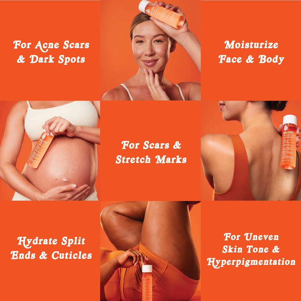 Bio-Oil Skincare Body Oil Serum, Face and Body Moisturizer with Vitamin E & A, for Scars, Stretch Marks, Sensitive Skin, All Skin Types, Dermatologist Recommended, Non-Comedogenic, 6.7 Oz
