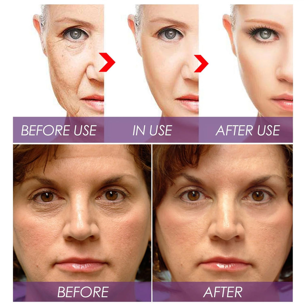 Venature Bakuchiol Retinol Rejuvenation Serum,2025 Best Retinol Serum for Wrinkles Bakuchiol Face Korean,