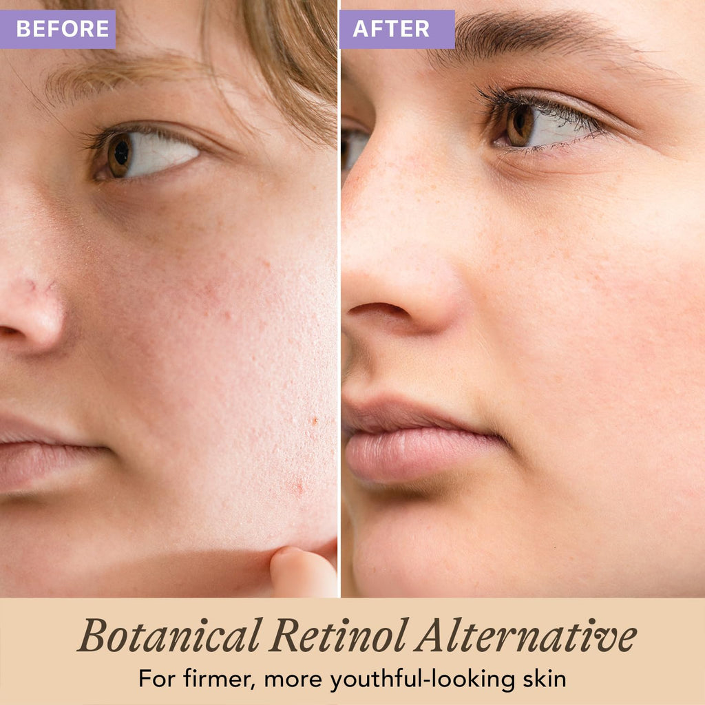 Bio Retinol Alternative Bakuchiol Serum - Smooths Skin & Reduces Fine Lines, USA Made with Natural & Organic Ingredients, Anti-Aging Skin Care Formula, Vegan, Cruelty Free
