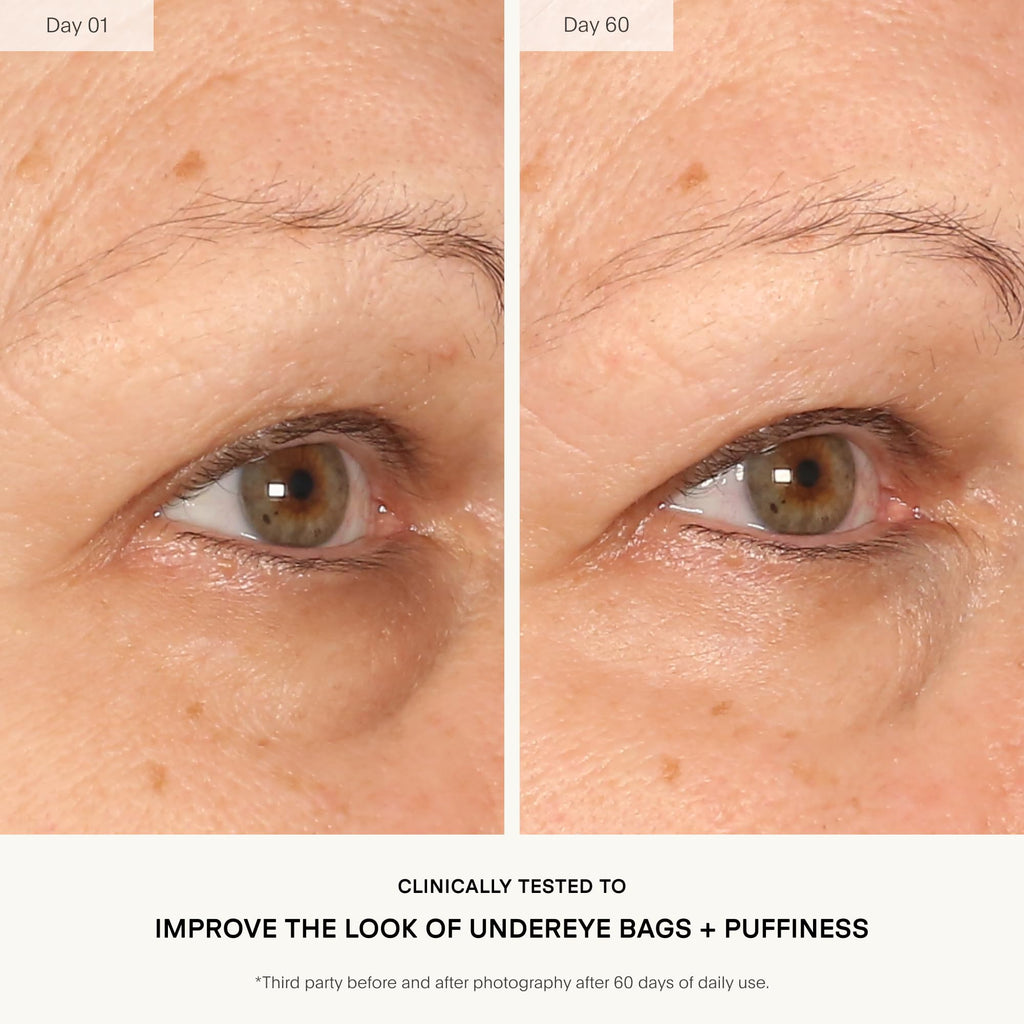 U Beauty The RETURN Eye Concentrate - Anti-Aging Eye Cream with Peptides and Antioxidants for Brighter and Tighter Under Eyes, Reduce Fine Lines, Puffiness & Dark Circles - 0.5 fl oz