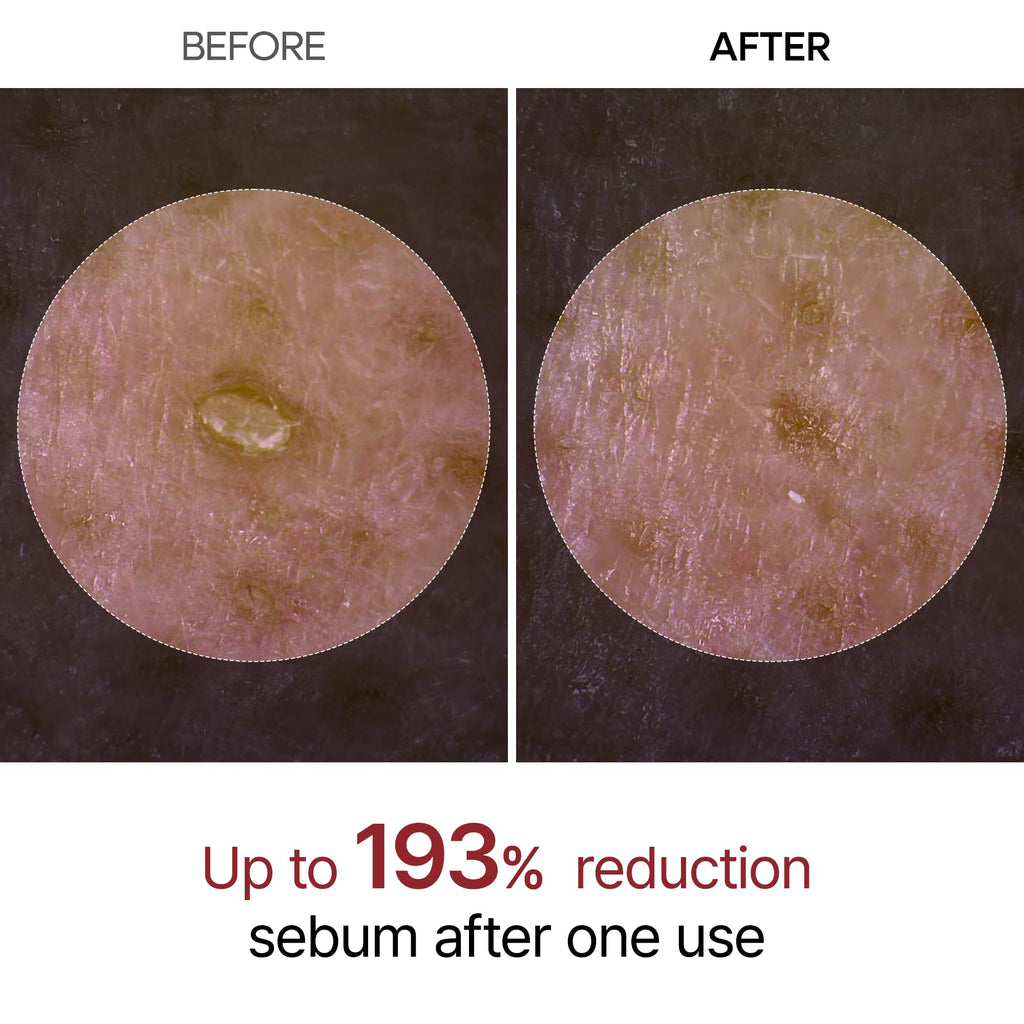 Dr.Melaxin Peel Shot Glow Rice Peeling Ampoule 80ml Daily Soft Exfoliating Face and Body Scrub Dead Skin Cells Blackhead Remover for All Skin Types korean skin care
