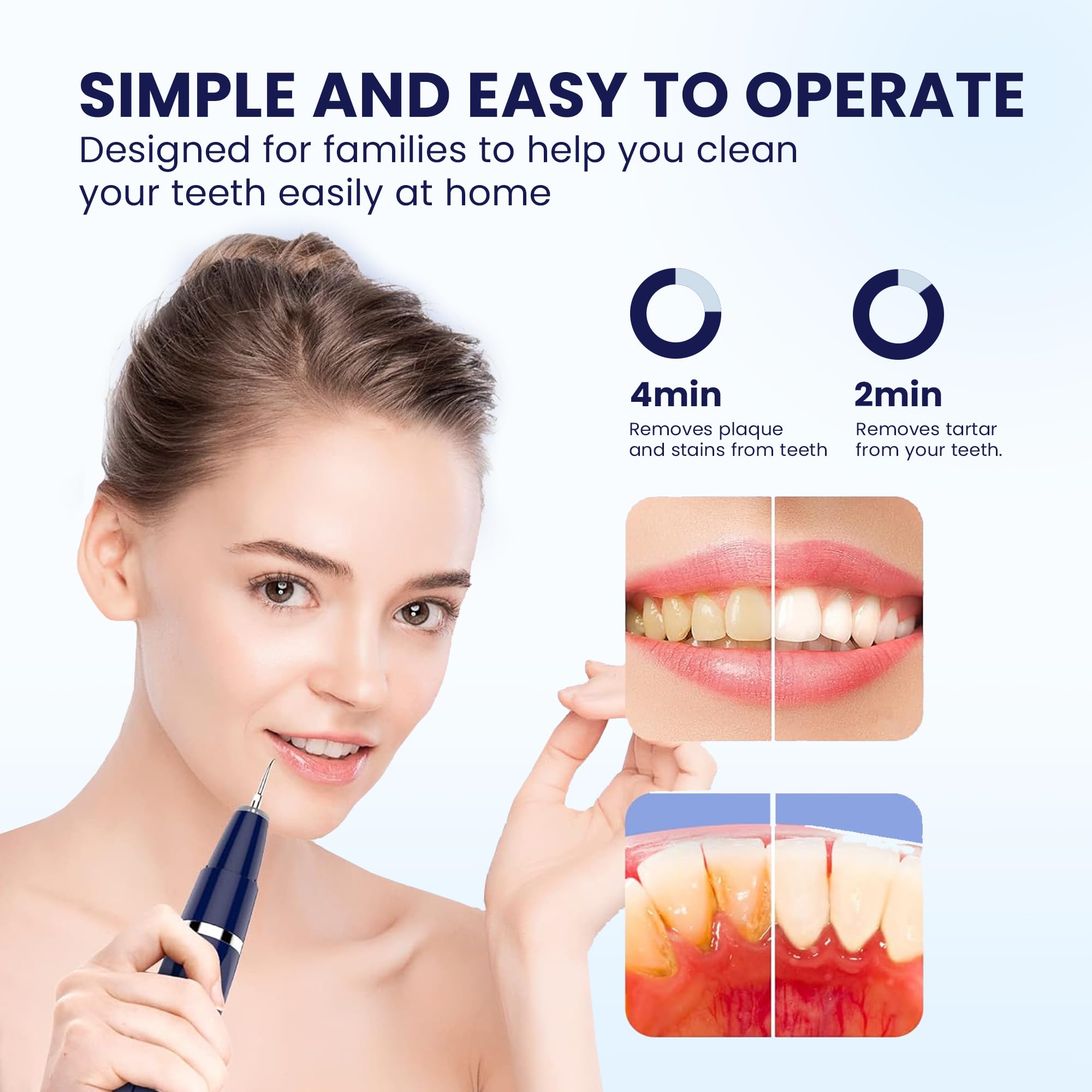 HOKIN Plaque Remover Dental Care Kit Teeth Cleaning Tool Dental Care Kit Tooth Filling Repair Set Stainless Steel Dental Tools for Men Women Kids and Pet Care (5)