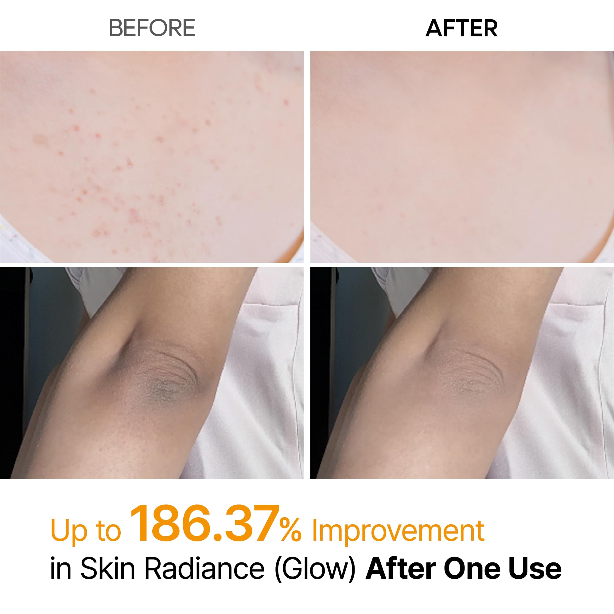 Dr.Melaxin Body Keratin Care Kojic Acid Turmeric Spray with AHA & PHA, Gentle Body Brightening & Exfoliating Peeling Solution for Dead Skin Cells & Texture, Korean Skincare, 6.76 fl.oz