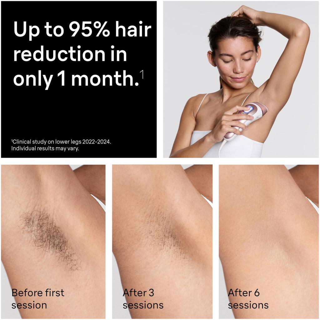 Braun Smart IPL, Vogue’s Best Hair Removal Device, Skin i·Expert Pro 7: at Home Laser Hair Removal, Permanent Visible Hair Reduction, Free App, Vanity Case, Venus Razor, 4 Smart Heads, IPL7387