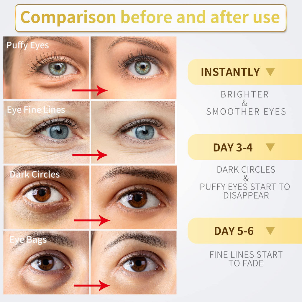 NAZANO 24K Gold Under Eye Patches - 60 Pack for Puffy Eyes, Dark Circles, Bags & Wrinkles with Collagen & Hyaluronic Acid - Eye Care Pads for Daily Skincare (Gold)