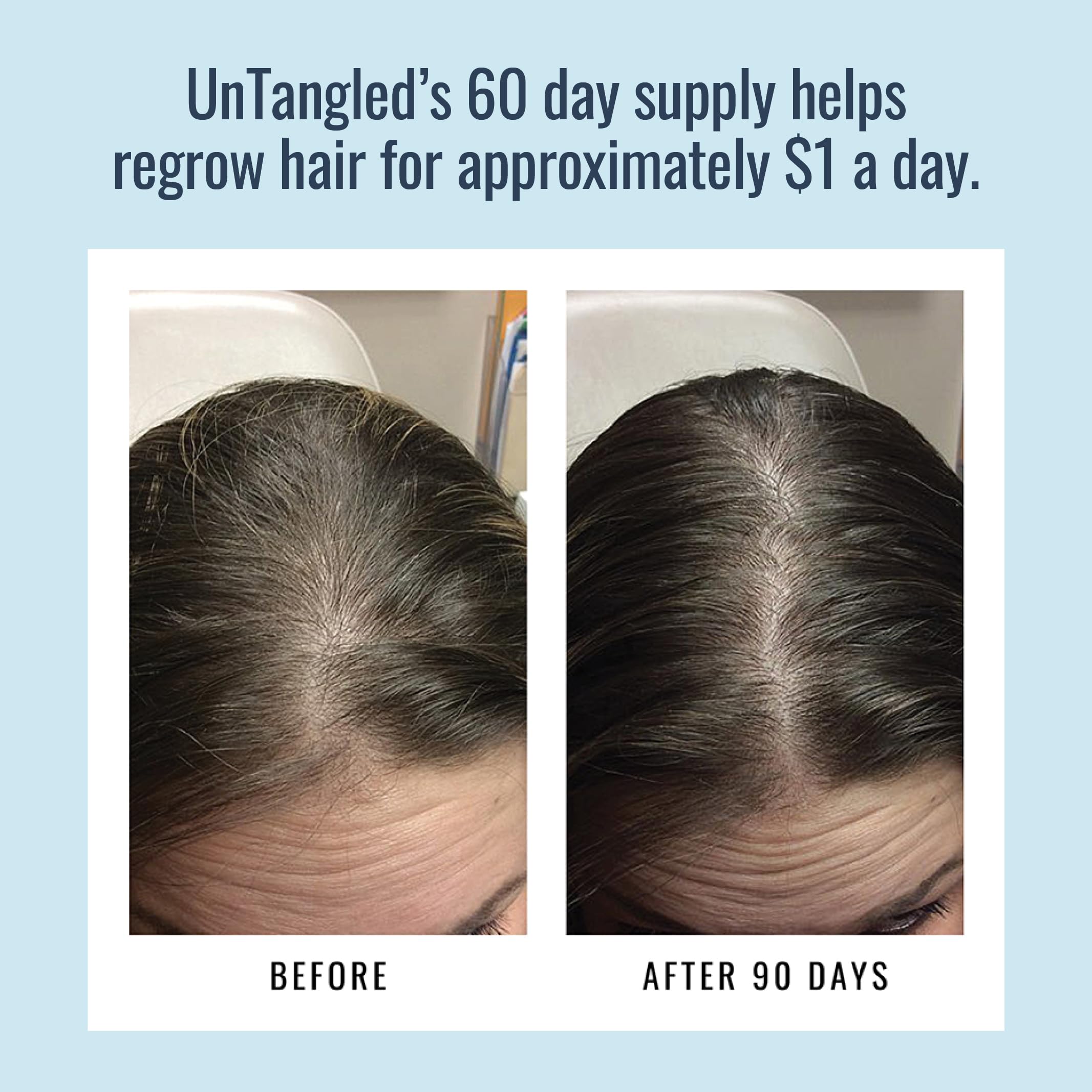 Foundation Skincare UnTangled Hair Vitamins (60-day supply) - Collagen & Biotin Supplement for Women & Men, Visibly Thicker, Faster Hair Growth