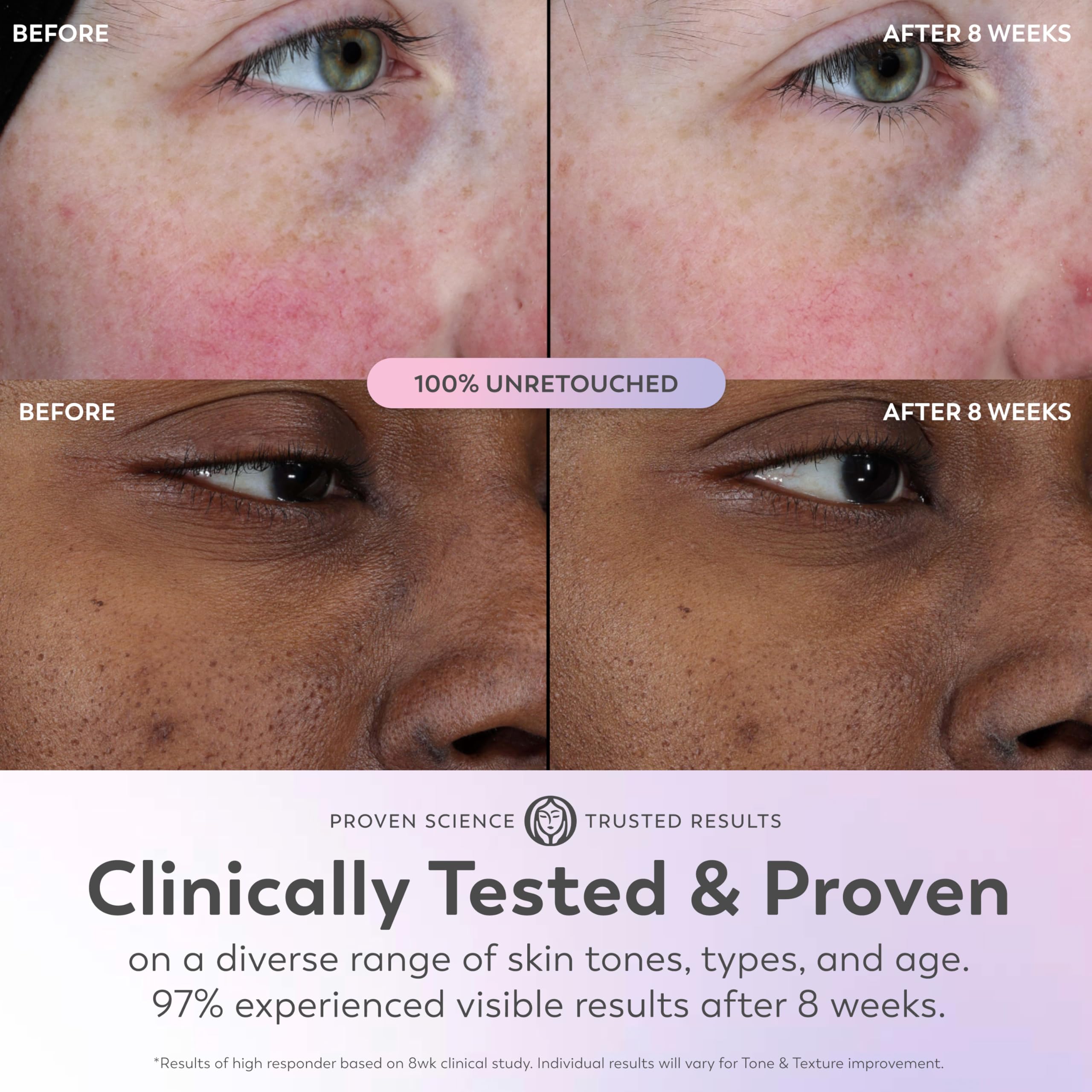 Olay Super Serum - Niacinamide, Vitamin C & E, Collagen Peptide, AHA - 5-in-1 Skin Care Benefits for Face - Healthy Glow, Brightening, Hydrating, Smoothing, Firming, Evens Tone, Anti-Aging, 1.7 Oz