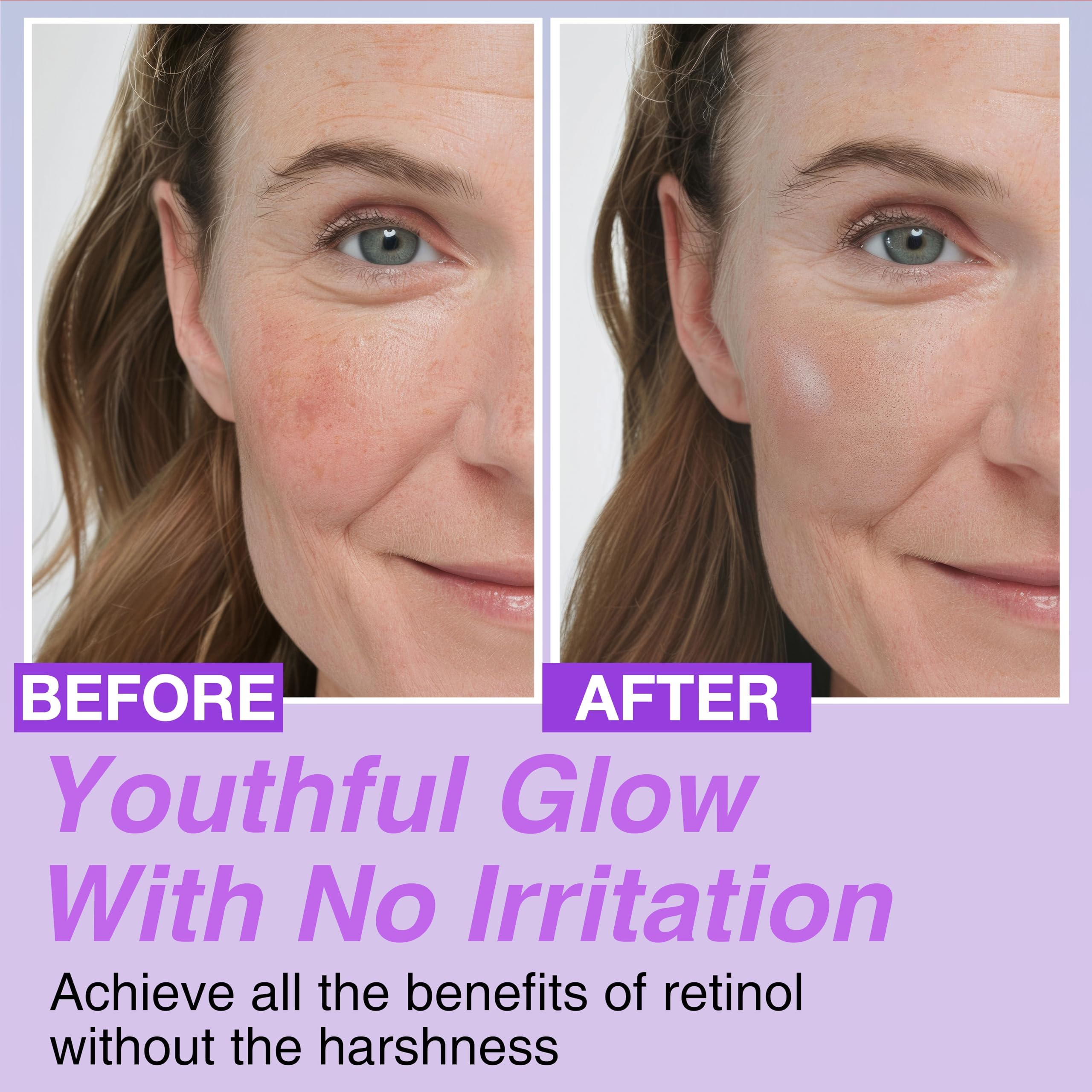 Korean Bakuchiol Concentrate DIY Mix-in Serum 30,000 ppm - High Potency Retinol Alternative | Wrinkle Reduction Skin Firming & Smoothing - Anti-Aging Sensitive Skin Vegan & Cruelty-Free Non-GMO 1 oz