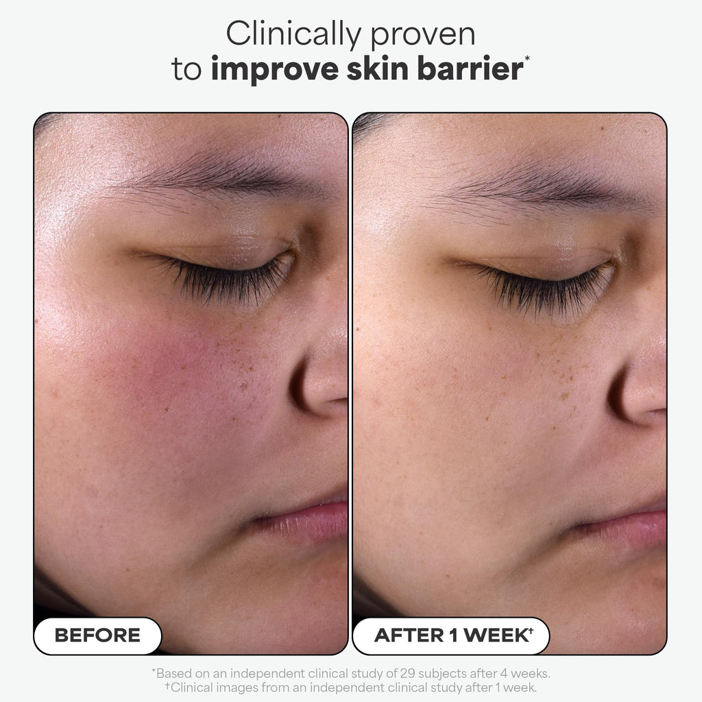 Paulas Choice--SKIN PERFECTING 2% BHA Liquid Salicylic Acid Exfoliant--Facial Exfoliant for Blackheads, Enlarged Pores, Wrinkles & Fine Lines, 4 oz Bottle