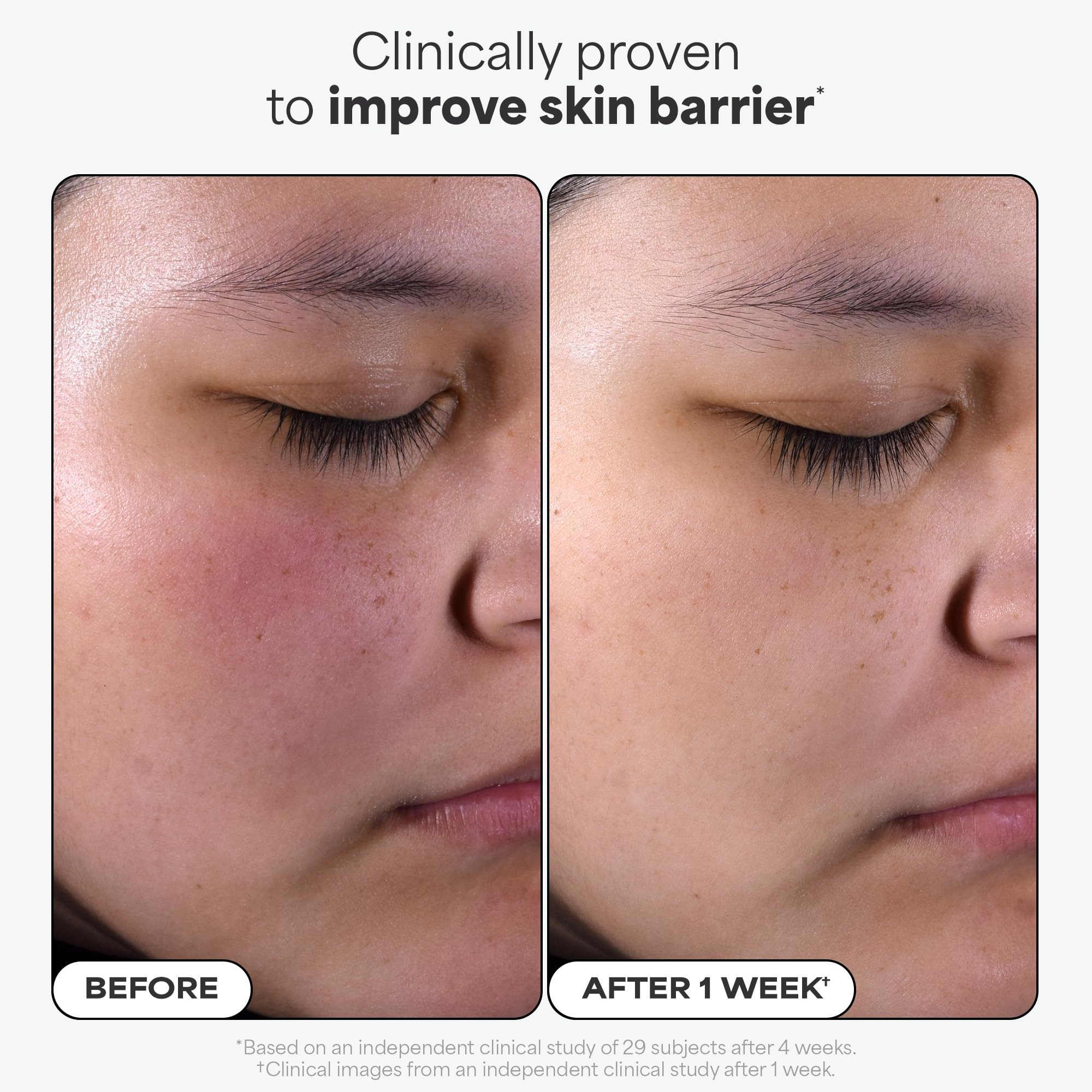 Paulas Choice--SKIN PERFECTING 2% BHA Liquid Salicylic Acid Exfoliant--Facial Exfoliant for Blackheads, Enlarged Pores, Wrinkles & Fine Lines, 4 oz Bottle