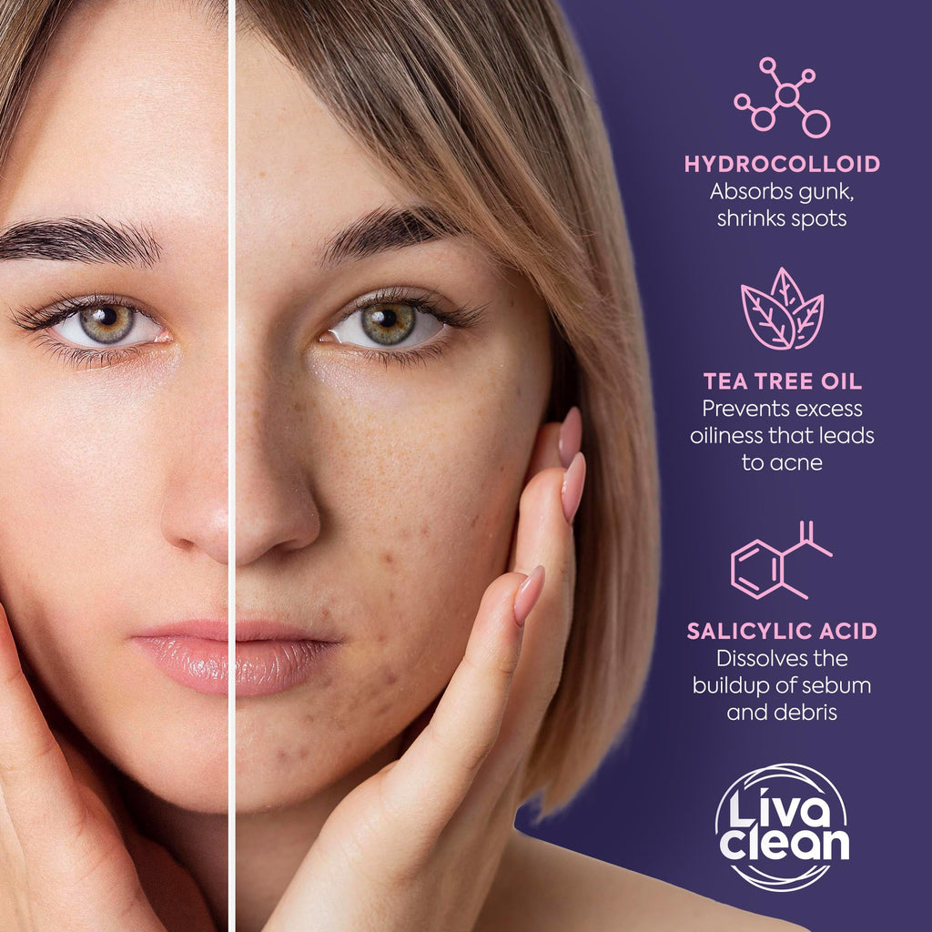 Livaclean Star Pimple Patches for Face w/ Hydrocolloid, Tea Tree oil & Salicylic Acid - Zit Stickers, Hydrocolloid Acne Patches for Face - Cute Pimple Patch, Acne Stickers