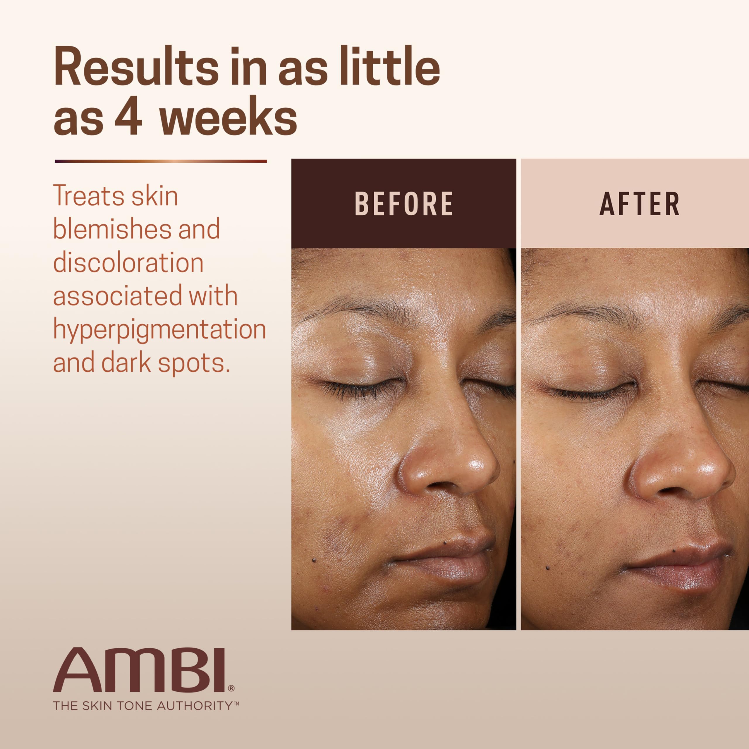 Ambi Even & Clear Advanced Fade Cream, Hydroquinone-free, Hyperpigmentation Treatment, Stubborn Dark Spot Corrector, Results In As Little As 2-3 Weeks, Niacinamide, Licorice Root Extract, PHA, 1 Fl Oz