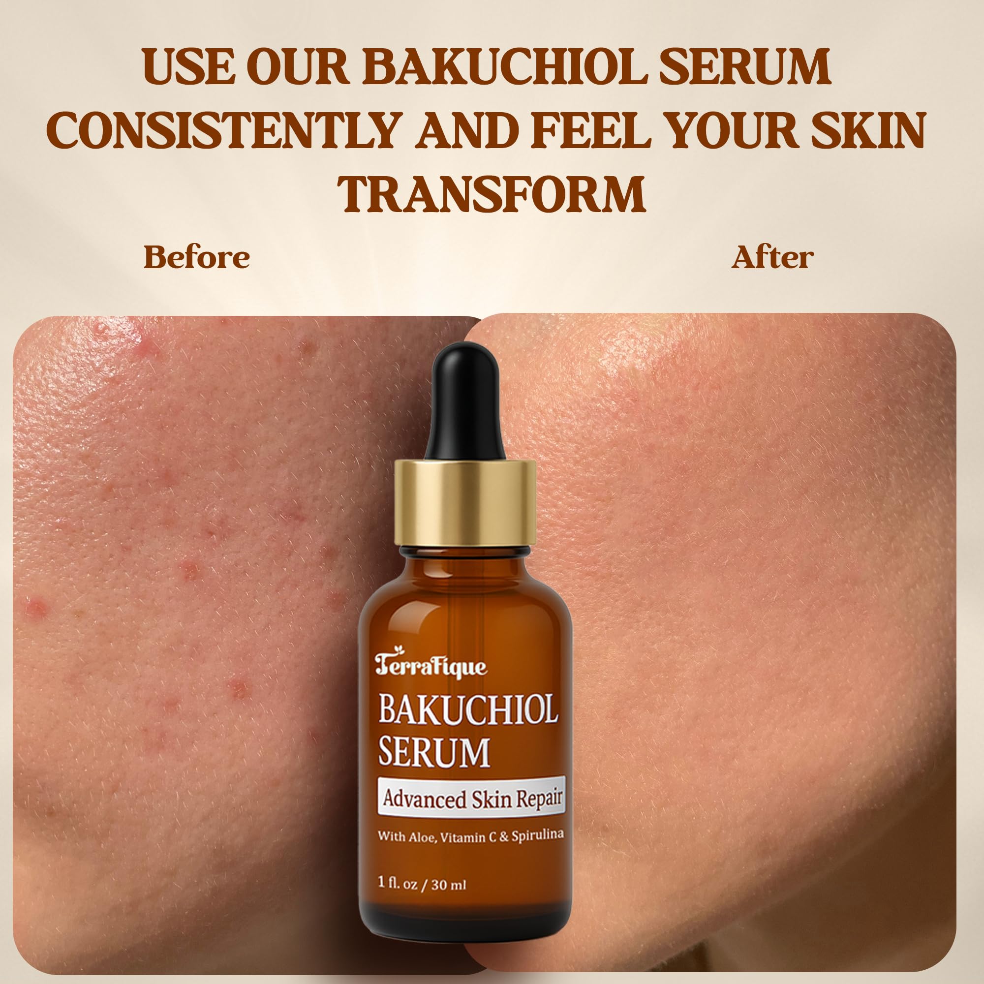 Terrafique Bakuchiol Serum - Retinol Alternative - Hydrating and Moisturizing - Can be Used on Sensitive Skin - Anti Aging - Also Contains Aloe, Witch Hazel, Centella, Spirulina - 1 Fl. Oz.