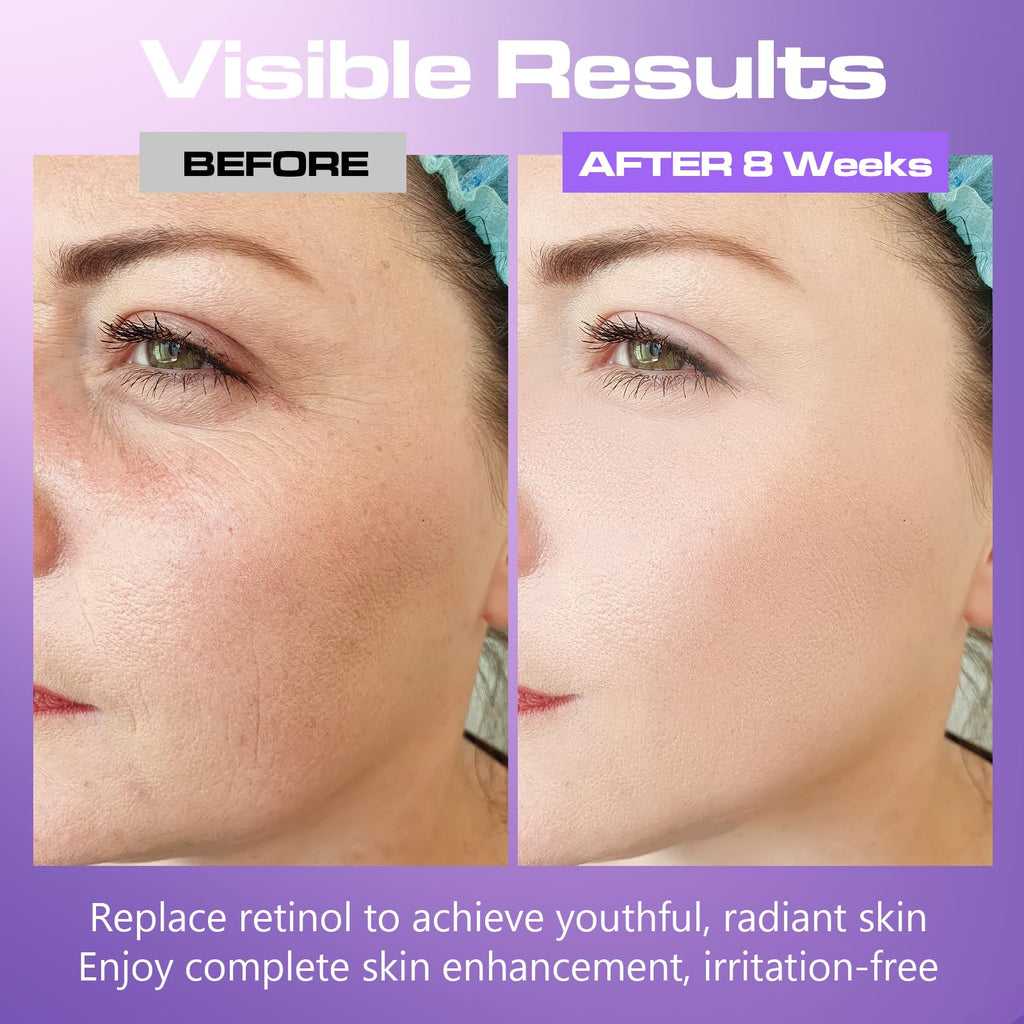 Viktairy Bakuchiol Serum Concentrate, High-Potency Mix-In Bakuchiol Oil Serum, Gentle Retinol Alternative for Wrinkle Reduction, Hydrating & Firming Anti-Aging Skincare, Vegan Non-GMO, 30ml 10,000ppm